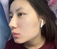 维特丝壬二酸15%凝胶祛痘药膏祛痘印淡痘印水杨酸胶态硫烟酰胺乳青春期 实拍图