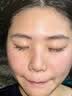 OHBT面膜美白淡斑补水保湿男女士熬夜舒缓抗皱紧致去黄气暗沉提亮肤色 实拍图