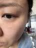 白云山眼部抗皱精华油虾青素面霜2+1套装紧致提拉紧致抗衰老淡化细纹 实拍图