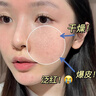 透真维生素b5精华液修护屏障受损敏感泛红晒后修复积雪草补水保湿提亮 实拍图