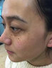 OHBT面膜美白淡斑补水保湿男女士熬夜舒缓抗皱紧致去黄气暗沉提亮肤色 实拍图