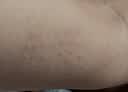 耐力克斯艾草自发热护肘手肘男女关节保护套保暖医用网球肘专用秋冬护具M 实拍图