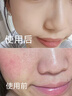 华美科湿敷水修复皮肤屏障受损修护爽肤补水保湿收缩毛孔精华液1瓶 实拍图