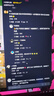漫步者（EDIFIER）R101V 2.1声道电脑音响音箱 台式机笔记本桌面音响 游戏音响 黑色 实拍图