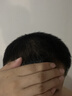 蔓迪【二代米诺地尔】蔓迪5%生发泡沫60g*2（敏皮专属 温和不油腻）男女士快速防脱育发米洛原液搽剂酊曼迪 实拍图