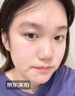 YYTISS医用面膜械字号冷敷贴医美激光术后修复保湿补水玻尿酸透明质酸钠 实拍图