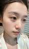 OHBT面膜美白淡斑补水保湿男女士熬夜舒缓抗皱紧致去黄气暗沉提亮肤色 实拍图
