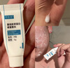 可复美重组胶原蛋白修复敷料敏感肌创面保护愈合乳液状R型40g 实拍图