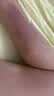 紫外线消毒灯移动式灭菌灯幼儿园杀菌灯家用除螨灯臭氧紫外灯 38W【遥控定时】【紫外线+臭氧】 实拍图