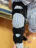麦德威（medwe）医用膝关节支具碳纤维膝盖固定支具支架腿部骨折韧带术后护膝护具 实拍图