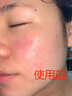 东洋之花玻尿酸原液精华液抗皱紧致精华提拉男女士衰老淡化细纹法令纹 实拍图