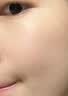 DR.MICKEY医用重组生长因子凝胶牛碱性成纤维细胞点痣喷人表皮祛疤痕膏修复 实拍图
