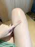 沃森博士果酸身体乳去鸡皮毛囊角质大腿烟酰胺嫩白补水保湿持久留香润肤露 实拍图