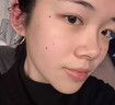 维A酸乳膏去疣体特新效期药扁平疣专用药去疣类药膏去脖子小肉粒颈部瘊子去尤瘊小肉粒去疣膏瘊子肉刺肉粒 1盒装【国药准字脱疣瘊】 瘊子去除国药准字药膏  放心购买 安心售后 实拍图