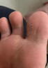 久卜制药脚气喷雾剂药止痒脱皮烂脚丫真菌感染狼毒王软膏脚臭痒克星治 3盒 实拍图