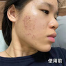 Aromat Herbs澳洲进口祛痘面膜祛痘印补水保湿美白控油收缩毛孔去黄提亮男女士 实拍图