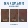 伊肤泉（EVE CHARM）医用护理液体敷料1.5ml*30支 透明质酸钠敷料械字号精华术后屏障 实拍图