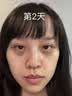 白云山黄芪眼霜淡化细纹黑眼圈眼袋抗皱紧致咖啡因熬夜眼霜国货一名20g 实拍图