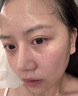 OHBT面膜美白淡斑补水保湿男女士熬夜舒缓抗皱紧致去黄气暗沉提亮肤色 实拍图