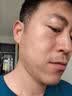 8度极光超凡810脱毛仪拉杆箱激光脱毛仪808冰点脱毛仪家用络腮胡男女全身腋下脱毛嫩肤美容院仪器 星耀810脱毛仪【家用/美容院】 10靶条【顶配热销款】推荐 实拍图