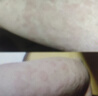 本安制药（BENAN PHARMACEUTICAL）荨麻疹专用膏皮肤瘙痒过敏止痒增强免疫力皮炎湿疹真菌3盒装 实拍图