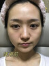 焦博士日本377美白祛斑霜氨甲环酸祛斑乳膏烟酰胺美白淡化黑色素去黄褐 实拍图