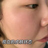 透真油橄榄精华液舒缓晒后修护屏障受损泛红收缩毛孔淡化痘印敏感肌 实拍图