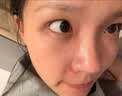 [花容美]阿达帕林凝胶 祛痘药膏祛痘印修复淡化痘印医用祛痘消炎痤疮专用青少年祛痘消炎痤疮专用皮肤用药 0.1%*10g 1盒装 【脸上起粉刺】 实拍图