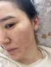 DR JEVEITAL 洁维塔博士神经酰胺晒后屏障修复面膜男女士补水保湿医美晒伤过敏舒缓b5面膜 实拍图