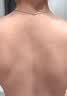 藤田制药毛囊炎头皮痒止痒脂溢性皮炎脓包长疙瘩马拉色菌后背长痘痘专用膏 实拍图
