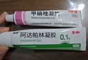 丽芙甲硝唑凝胶20g+阿达帕林16g甲硝酸锉凝胶去痘痘祛痘印药膏消炎痤疮修复淡化 实拍图