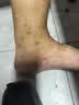 特步（XTEP）运动拖鞋子男款青少年洞洞鞋男外穿沙滩凉鞋男七夕礼物黑色44-45 实拍图