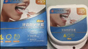 协和京品牙套防磨牙套睡觉磨牙专用神器成人夜间磨牙垫专用口腔护齿神器牙齿防护牙套IVT001B 实拍图