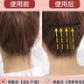 东义严选倒插梳发卡3把前额碎发神器发箍后脑勺发梳头饰女固定刘海整理 实拍图