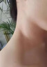 维A酸乳膏去疣体特新效期药扁平疣专用药去疣类药膏去脖子小肉粒颈部瘊子去尤瘊小肉粒去疣膏瘊子肉刺肉粒 1盒装【国药准字脱疣瘊】 瘊子去除国药准字药膏  放心购买 安心售后 实拍图