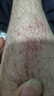 UWANT友望大白ultra除螨仪 热销TOP1大功率宠物除毛床上吸尘器高温杀菌吸尘三合一 大吸力双杯除螨机 实拍图