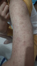 岩井昃弘鸡皮肤疙瘩毛囊角化专用去除大腿胳膊手臂神器药膏脸上儿童身体乳 单盒装【鸡皮肤克星】 去除毛周角化症皮肤干燥磨砂膏尿素霜精华 实拍图