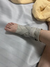 CRALVKOIN医用踝关节固定支具护踝崴脚伤后康复脚踝扭伤骨折支撑护具可穿鞋 实拍图