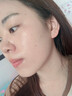 藤石制药激光点痣后脸部去红印黑印凹陷修复凝胶祛痣疤痕膏淡化红印色素DS 单盒装 实拍图