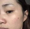 沃森博士氨甲环酸乳膏去黄褐斑传明酸凝胶分解黑色素提亮肤色修护精华液 实拍图