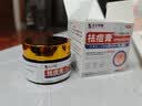 本安制药祛痘药膏青春痘祛痘淡化痘印痘坑痤疮粉刺专用青少年1盒 实拍图