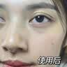 焦博士日本377美白祛斑霜氨甲环酸祛斑乳膏烟酰胺美白淡化黑色素去黄褐 实拍图