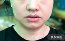 井次制药去痣点痣膏水脸部痦子扁平疣瘊子面部黑痣男女士通用试用装 实拍图