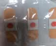 云南本草鸡眼贴鸡眼膏去脚根肉刺药膏无痛脱落扁平疣手足老茧脚底趾疣刺猴 实拍图