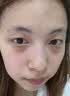 山本星奈眼霜淡化细纹提拉紧致黑眼圈重度去除祛男女士熬夜黑色素专用的药 单盒装【快速去黑眼圈】 实拍图