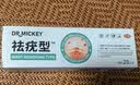 DR.MICKEY制药祛去疣体脱落膏扁平疣专用跖疣尖锐湿丝状疣瘊灵脖子肉粒颈部 实拍图
