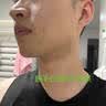 8度极光超凡810脱毛仪拉杆箱激光脱毛仪808冰点脱毛仪家用络腮胡男女全身腋下脱毛嫩肤美容院仪器 星耀810脱毛仪【家用/美容院】 10靶条【顶配热销款】推荐 实拍图
