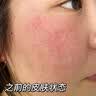 透真油橄榄精华液舒缓晒后修护屏障受损泛红收缩毛孔淡化痘印敏感肌 实拍图