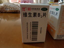 力生 维生素B2片 5mg*100片*5瓶 用于预防和治疗维生素B2缺乏症 口腔溃疡嘴巴上火起泡嘴唇干裂国药准字 实拍图