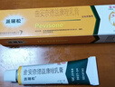 【原研好药】派瑞松 曲安奈德益康唑乳膏软膏15g正品皮炎湿疹过敏止痒水泡脚气 手足癣体癣股癣花斑癣 甲沟炎 实拍图